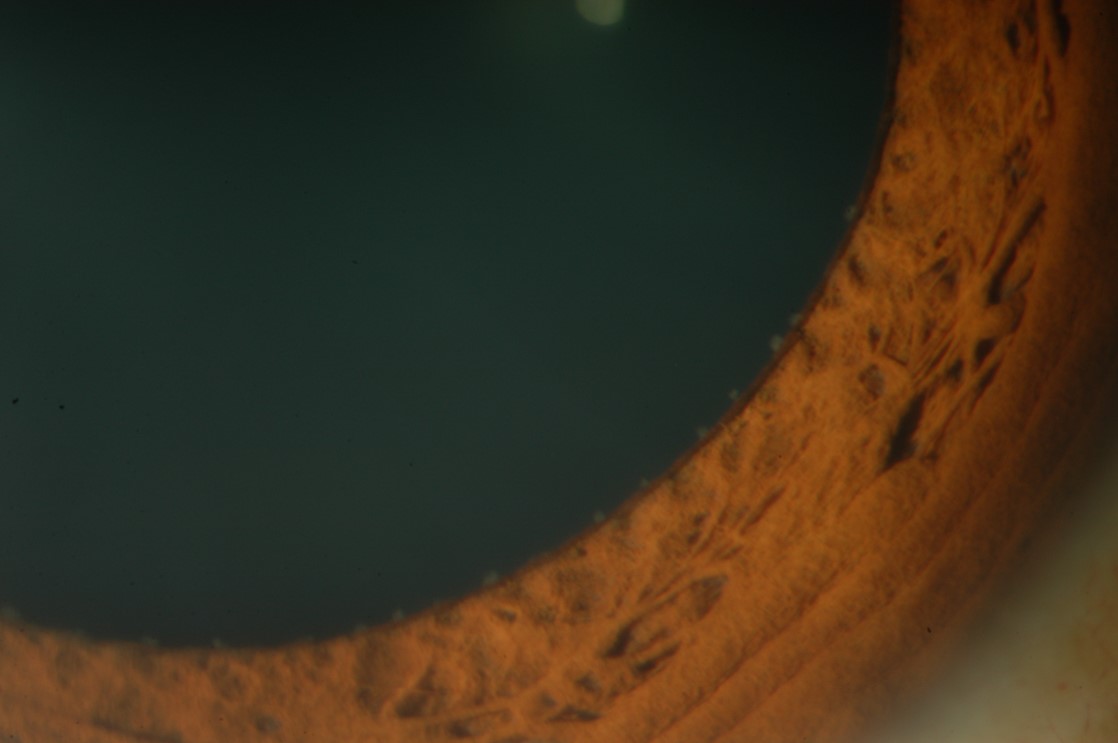 Figure 4.1.2 Koeppe Nodules