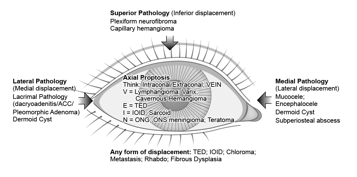 Figure 5.7.1 Proptosis Differential Diagnosis