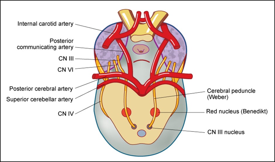 Figure 7.2.10 Brainstem relations of CNIV
