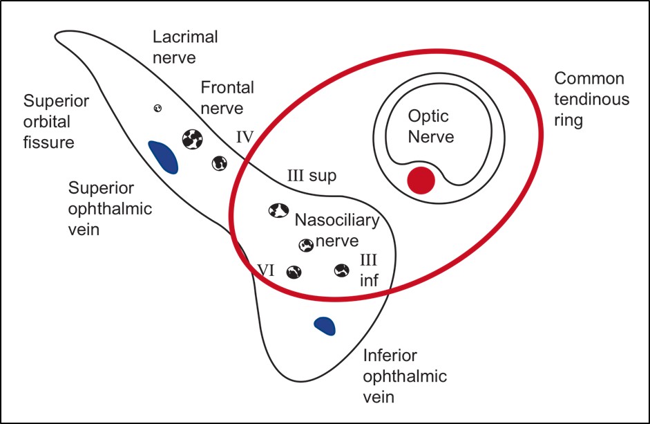 Figure 7.3.6 Relations of CNVI in the Superior Orbital Fissure