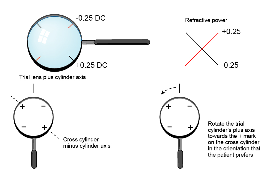 Figure 8.2.3 Using the Jackson Cross Cylinder to Determine the Cylinder Axis