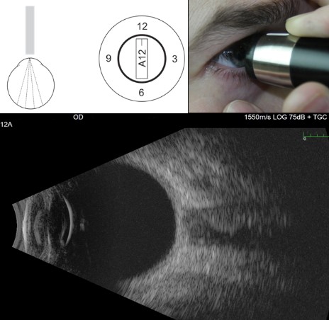 Figure 9.10.1 Axial B-scan