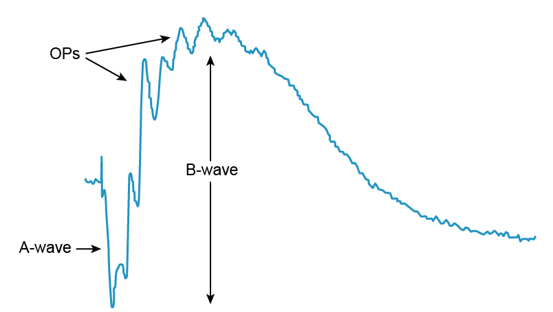 Figure 9.11.1 Typical ERG Waveforms