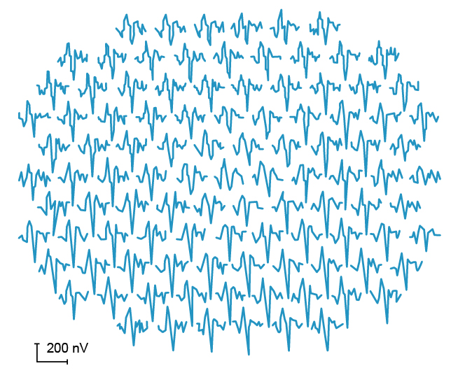 Figure 9.11.4 Normal Multifocal ERG