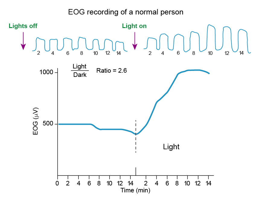 Figure 9.11.5 A Normal EOG Recording