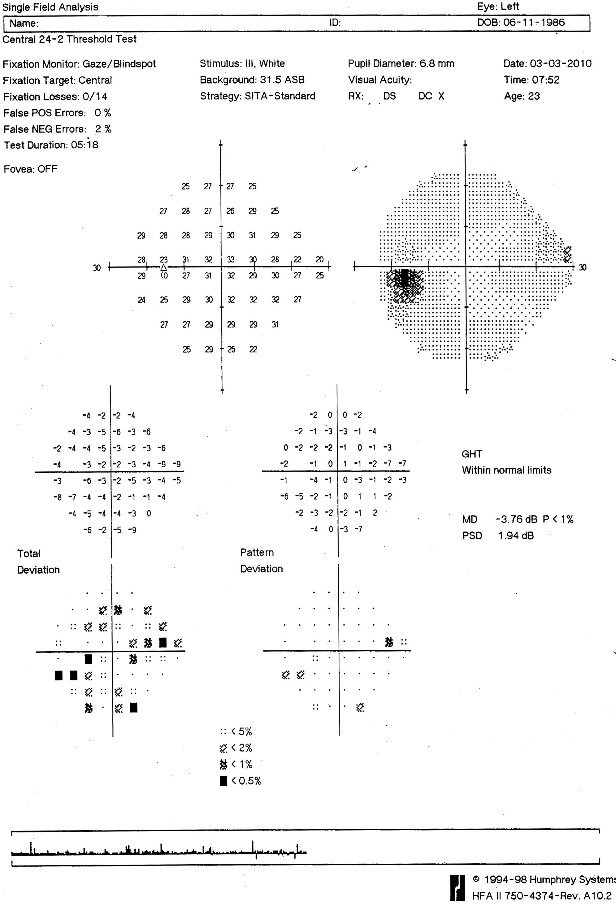 Figure 9.12.1 Normal HVF (Left)