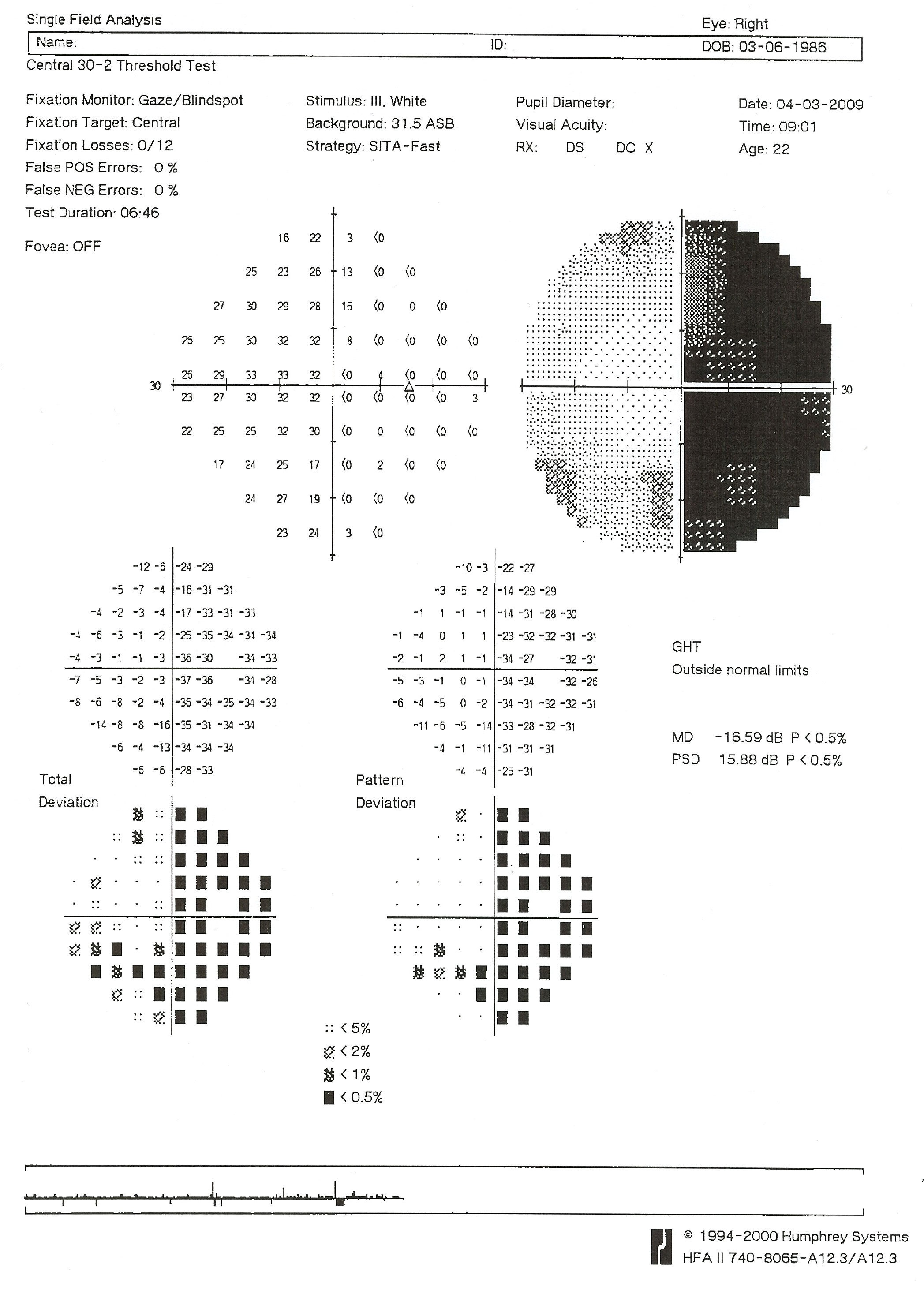 Automated Visual Fields 9.12 Westmead Eye Manual