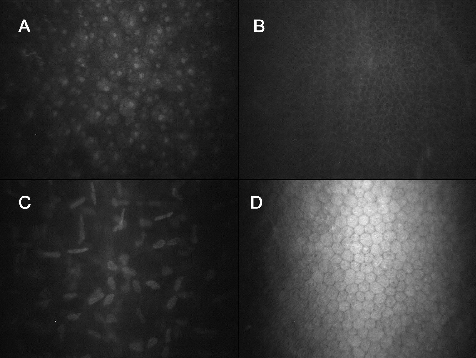 Figure 9.2.1 Normal Cornea