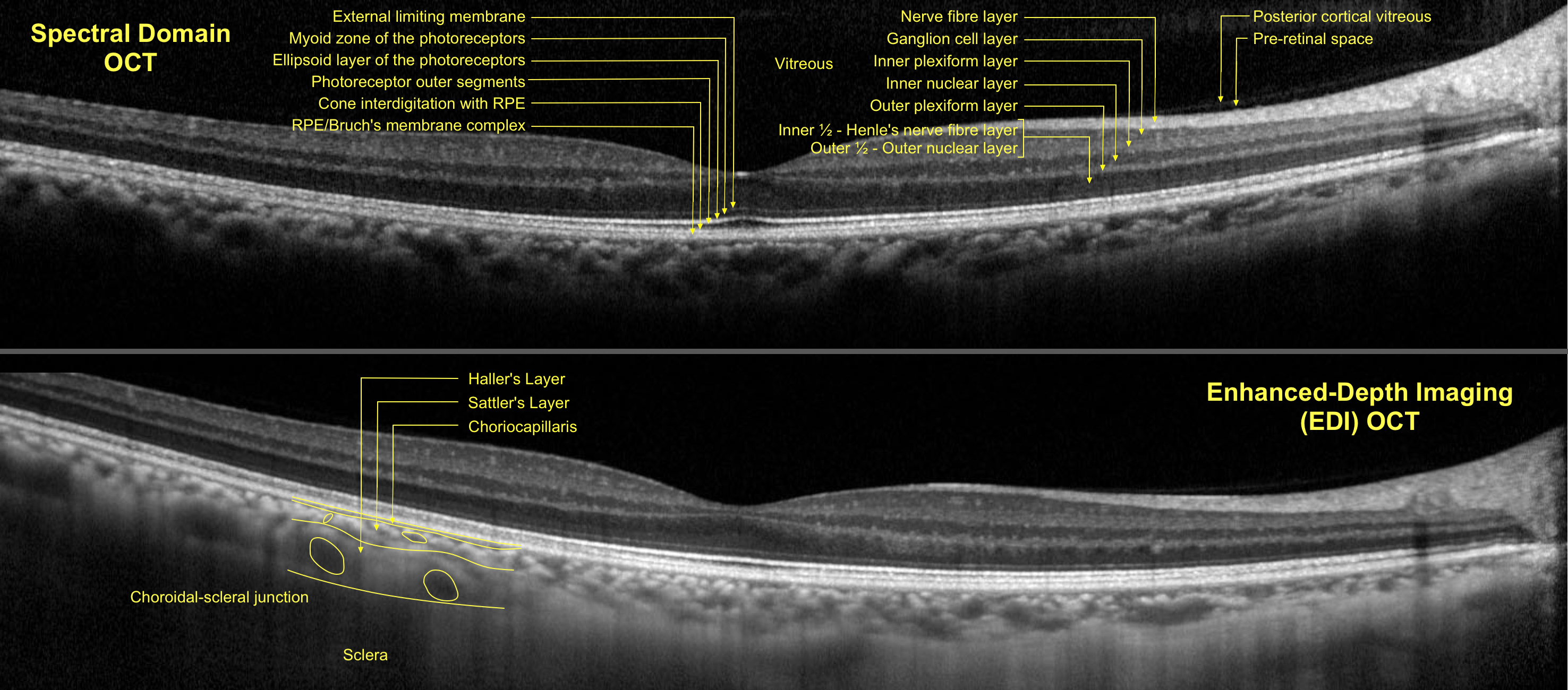 Figure 9.2.1 Normal Cornea