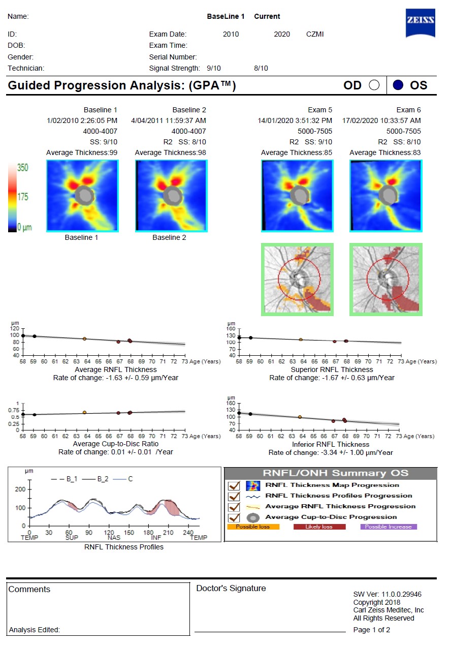 Figure 9.5.2 OCT RNFL – GPA, Inferior temporal retinal nerve fibre layer loss (left)